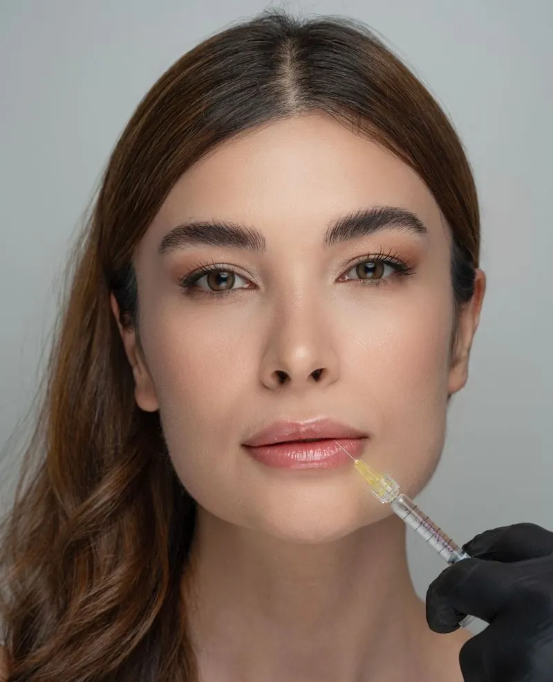 Woman having dermal filler placed in her lips by a practitioner in black gloves