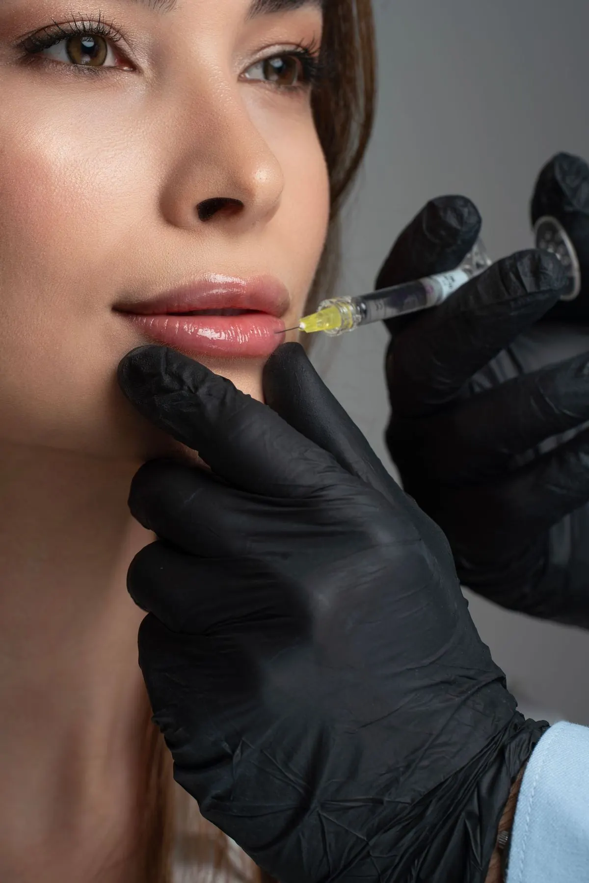 Close-up of a lip filler treatment being carried out by a gloved practitioner