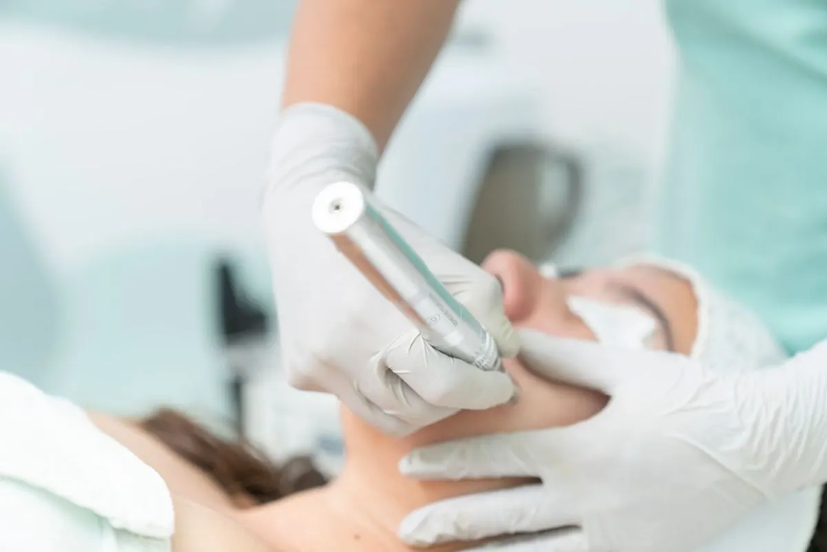 Close-up of a microdermabrasion handpiece gliding over the skin
